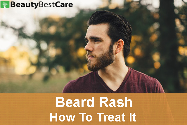 beard rash , what is it and how to treat it