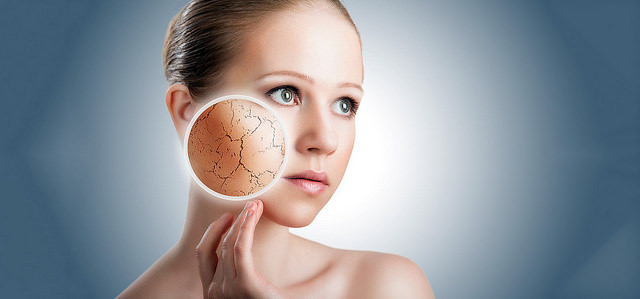 dry skin on face