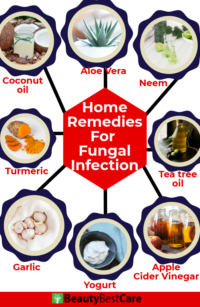 home remedies for fungal infection